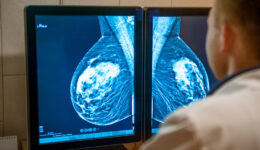 Federal guidelines on mammograms are changing