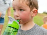 A child dehydrated from high heat.
