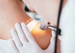 A doctor examines skin for melanoma.