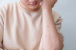 A man shows his scar before treatment.