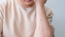 What’s the best treatment for your scar type?