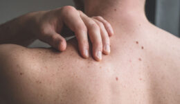 Tips for taking care of your body’s largest organ