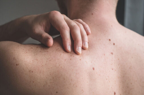 Tips for taking care of your body’s largest organ