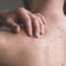 Tips for taking care of your body’s largest organ