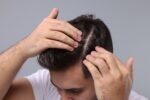 A man notices hair loss.