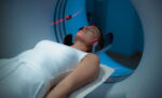 A woman gets a scan for brain tumor.