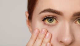 Can adults experience jaundice?