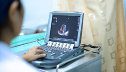 How to prepare your child for an echocardiogram