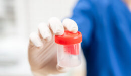 The hidden health clues in your urine