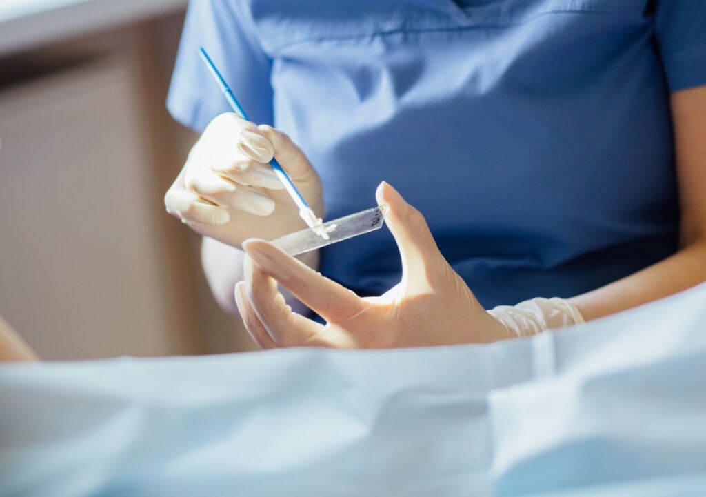 Pap smear fear: What happens after an abnormal result?