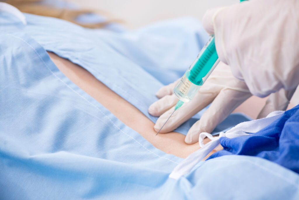 From buttocks to neck: Epidural steroid injections for radiating pain relief