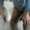Osteoporosis is not just a women’s health condition